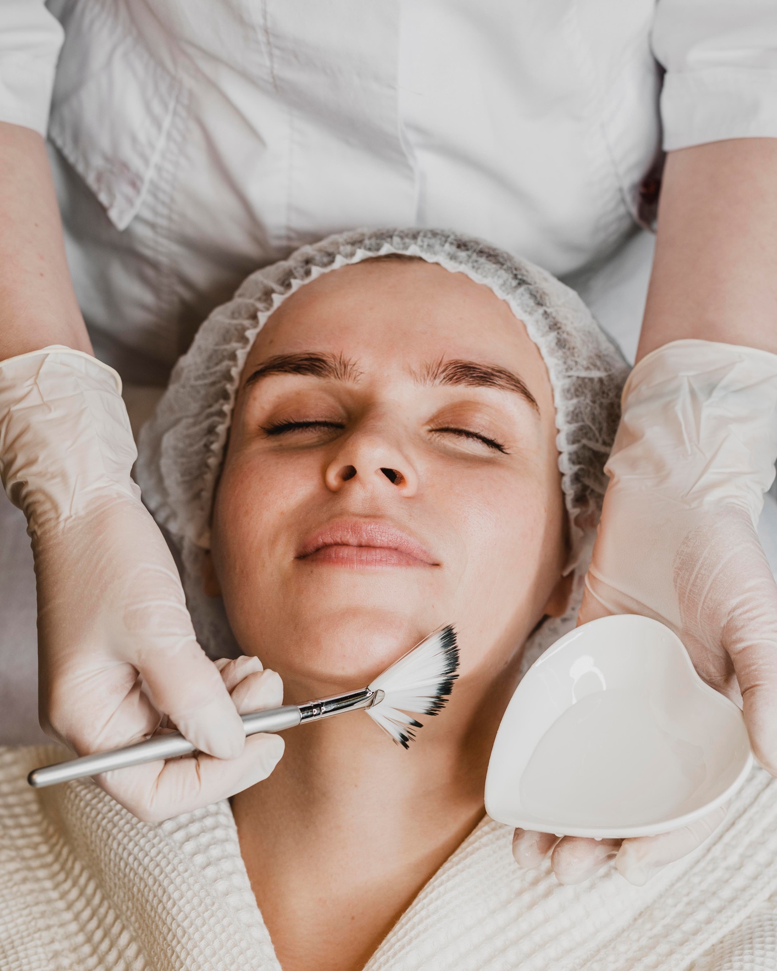 Chemical Peels